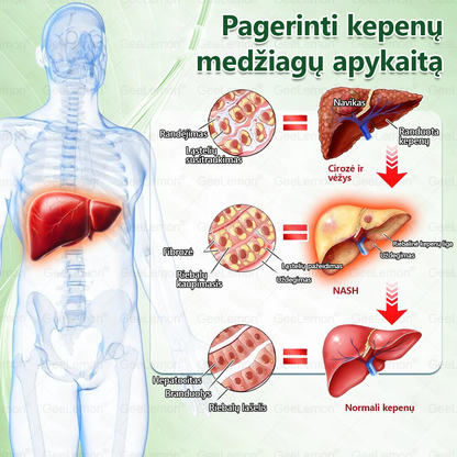 𝐆𝐞𝐞𝐋𝐞𝐦𝐨𝐧®🎁 Liko tik 5 pakuotės!Gaukite papildomą 50 % nuolaidą!✨Pradėkite savo sveikesnio gyvenimo būdo kelionę jau šiandien!