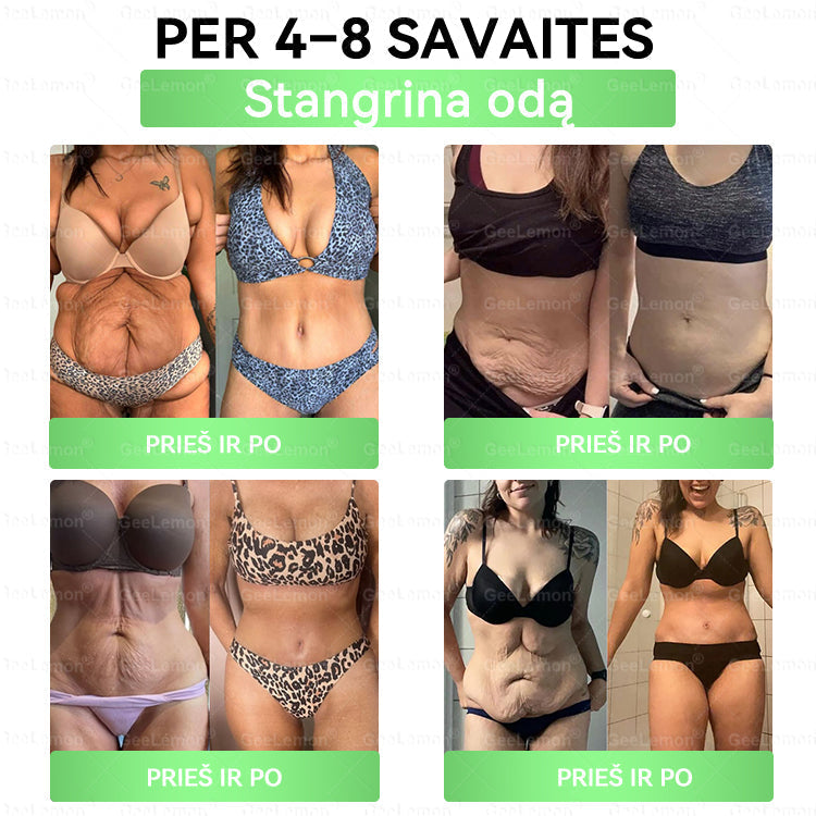 𝐆𝐞𝐞𝐋𝐞𝐦𝐨𝐧®🎁 Liko tik 5 pakuotės!Gaukite papildomą 50 % nuolaidą!✨Pradėkite savo sveikesnio gyvenimo būdo kelionę jau šiandien!