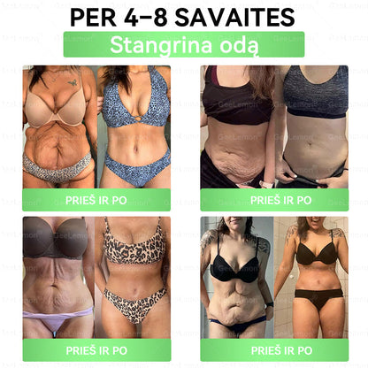 𝐆𝐞𝐞𝐋𝐞𝐦𝐨𝐧®🎁 Liko tik 5 pakuotės!Gaukite papildomą 50 % nuolaidą!✨Pradėkite savo sveikesnio gyvenimo būdo kelionę jau šiandien!