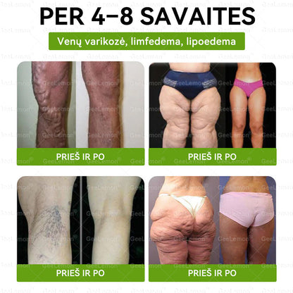 𝐆𝐞𝐞𝐋𝐞𝐦𝐨𝐧®🎁 Liko tik 5 pakuotės!Gaukite papildomą 50 % nuolaidą!✨Pradėkite savo sveikesnio gyvenimo būdo kelionę jau šiandien!