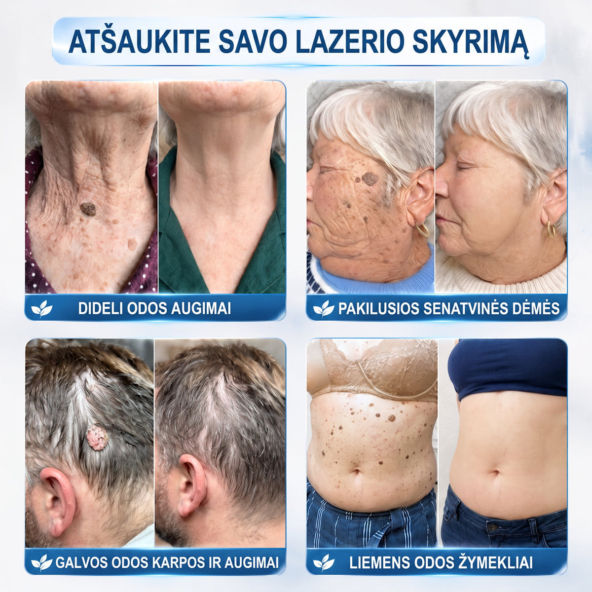 Hiskin®🎁 Liko tik 5 vnt. sandėlyje! 🔥 Pasinaudokite papildoma 50 % nuolaida! ✨ Užsisakykite dabar ir atnaujinkite savo odos priežiūros rutiną. Nepraleiskite šio ypatingo pasiūlymo! ⏰ Pasiūlymas galioja tik ribotą laiką!