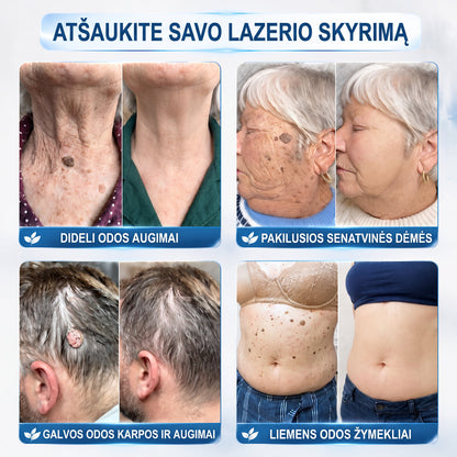 Hiskin®🎁 Liko tik 5 vnt. sandėlyje! 🔥 Pasinaudokite papildoma 50 % nuolaida! ✨ Užsisakykite dabar ir atnaujinkite savo odos priežiūros rutiną. Nepraleiskite šio ypatingo pasiūlymo! ⏰ Pasiūlymas galioja tik ribotą laiką!