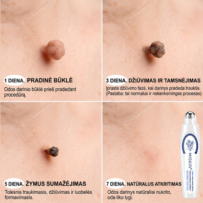 Hiskin®🎁 Liko tik 5 vnt. sandėlyje! 🔥 Pasinaudokite papildoma 50 % nuolaida! ✨ Užsisakykite dabar ir atnaujinkite savo odos priežiūros rutiną. Nepraleiskite šio ypatingo pasiūlymo! ⏰ Pasiūlymas galioja tik ribotą laiką!