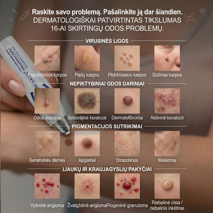 Hiskin®🎁 Liko tik 5 vnt. sandėlyje! 🔥 Pasinaudokite papildoma 50 % nuolaida! ✨ Užsisakykite dabar ir atnaujinkite savo odos priežiūros rutiną. Nepraleiskite šio ypatingo pasiūlymo! ⏰ Pasiūlymas galioja tik ribotą laiką!